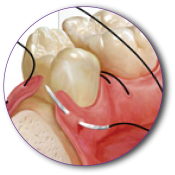 Chirurgie orală